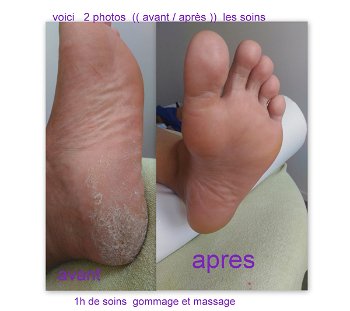 Annonce massage des pieds feminin gratuit Mulhouse Haut Rhin